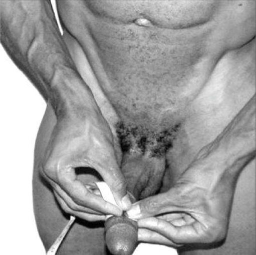 merjenje penisa pred povečanjem