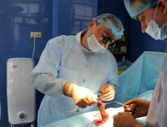 Operacija za povečanje penisa, ki jo izvajajo kirurgi
